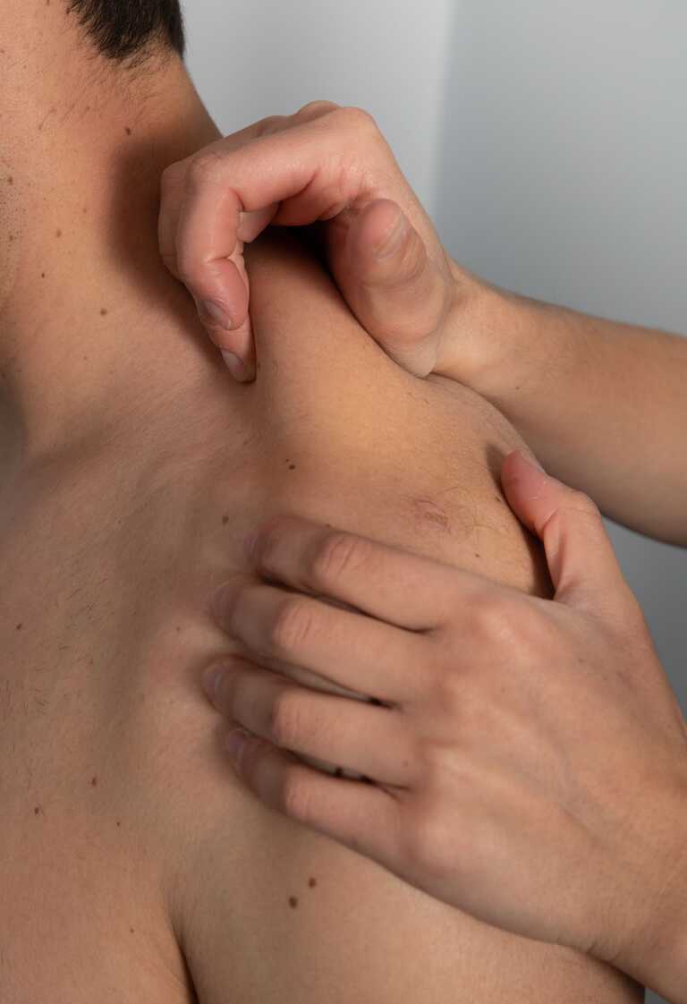 Fisioterapia